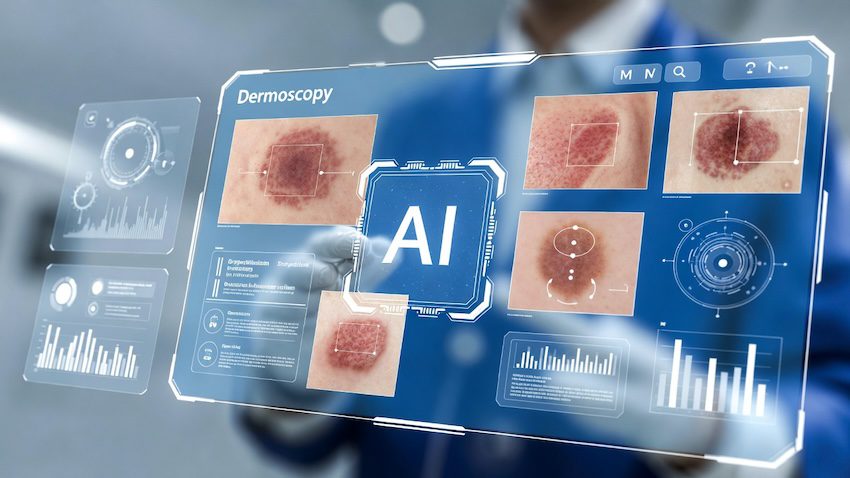 AI-powered dermoscopy analysis in Legend EHR